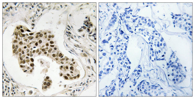 PMS2/PMS2CL Antibody in Immunohistochemistry (Paraffin) (IHC (P))