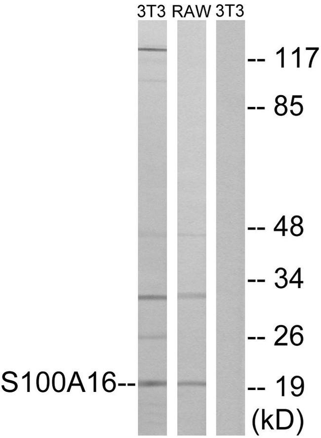 S100A16 Antibody in Western Blot (WB)