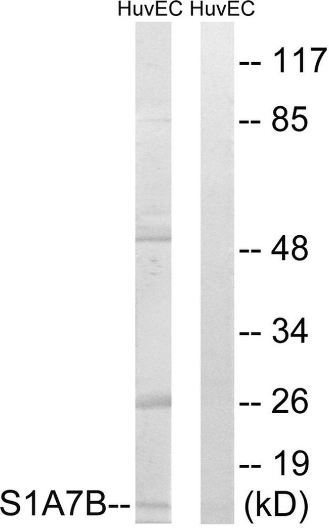 S100A7L2 Antibody in Western Blot (WB)
