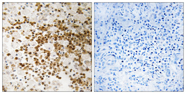 S100P Antibody in Immunohistochemistry (Paraffin) (IHC (P))