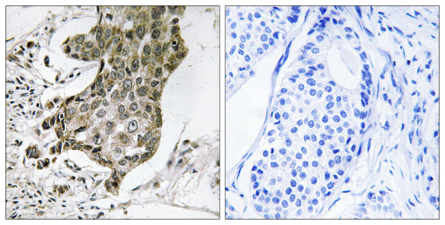 RABEP1 Antibody in Immunohistochemistry (Paraffin) (IHC (P))