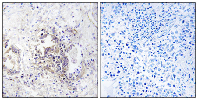 CHML Antibody in Immunohistochemistry (Paraffin) (IHC (P))