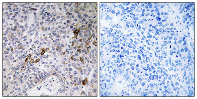RAB11FIP3 Antibody in Immunohistochemistry (Paraffin) (IHC (P))