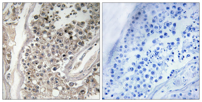 RAB3GAP1 Antibody in Immunohistochemistry (Paraffin) (IHC (P))