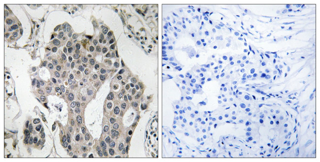 RAB3GAP2 Antibody in Immunohistochemistry (Paraffin) (IHC (P))