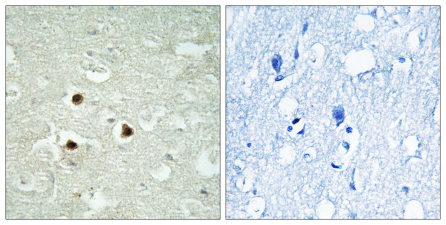 RAB3IP Antibody in Immunohistochemistry (Paraffin) (IHC (P))