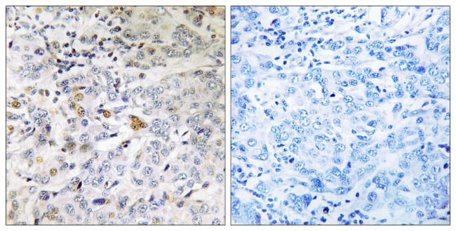 RABL5 Antibody in Immunohistochemistry (Paraffin) (IHC (P))