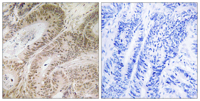 RDM1 Antibody in Immunohistochemistry (Paraffin) (IHC (P))