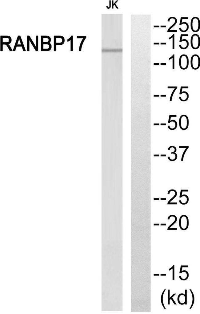RANBP17 Antibody in Western Blot (WB)