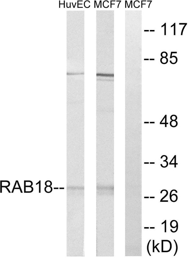 RAB18 Antibody in Western Blot (WB)