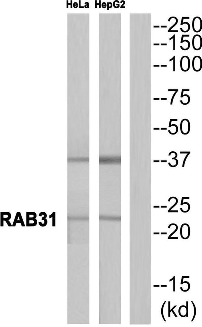 RAB31 Antibody in Western Blot (WB)