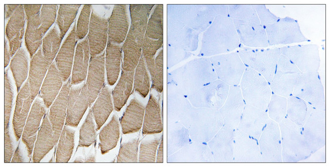RAB34 Antibody in Immunohistochemistry (Paraffin) (IHC (P))