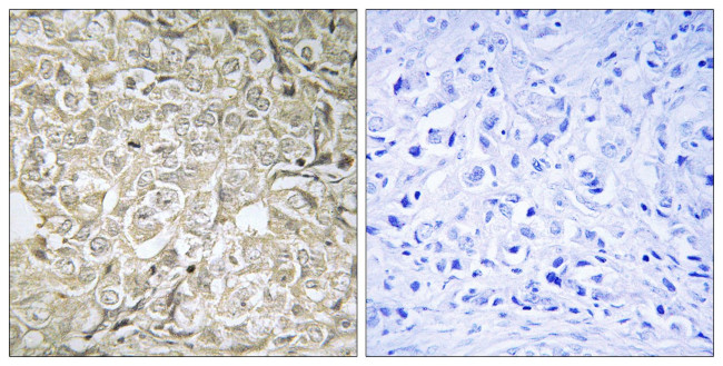 RAB37 Antibody in Immunohistochemistry (Paraffin) (IHC (P))