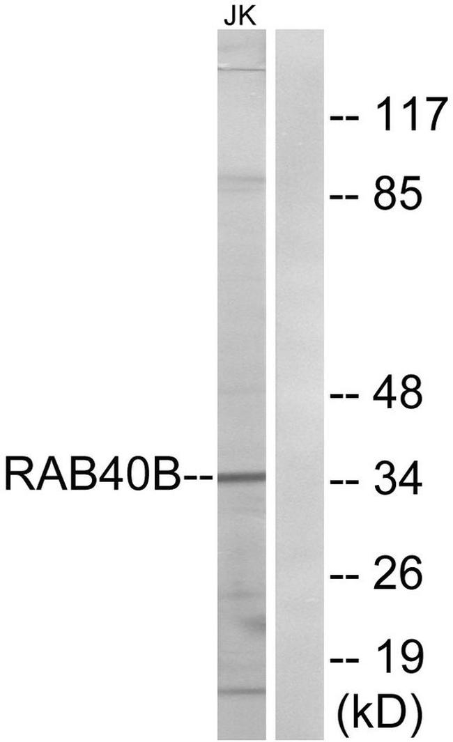 RAB40B Antibody in Western Blot (WB)