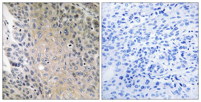 RAB41 Antibody in Immunohistochemistry (Paraffin) (IHC (P))