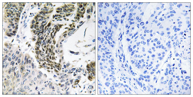 RREB1 Antibody in Immunohistochemistry (Paraffin) (IHC (P))