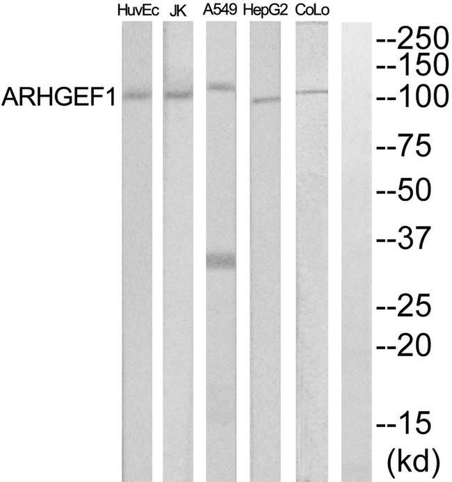ARHGEF1 Antibody in Western Blot (WB)
