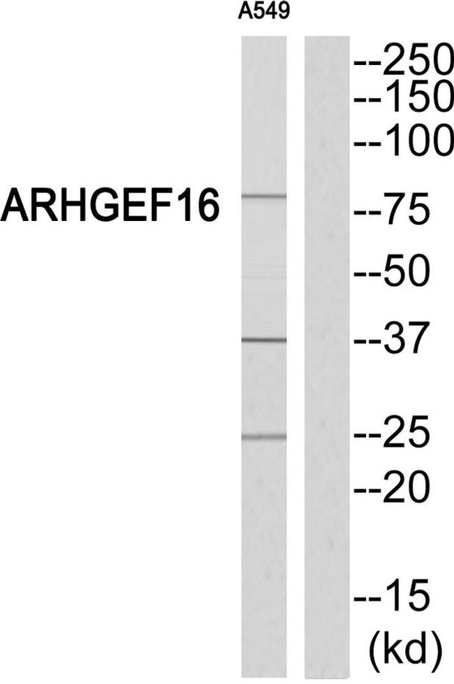 ARHGEF16 Antibody in Western Blot (WB)