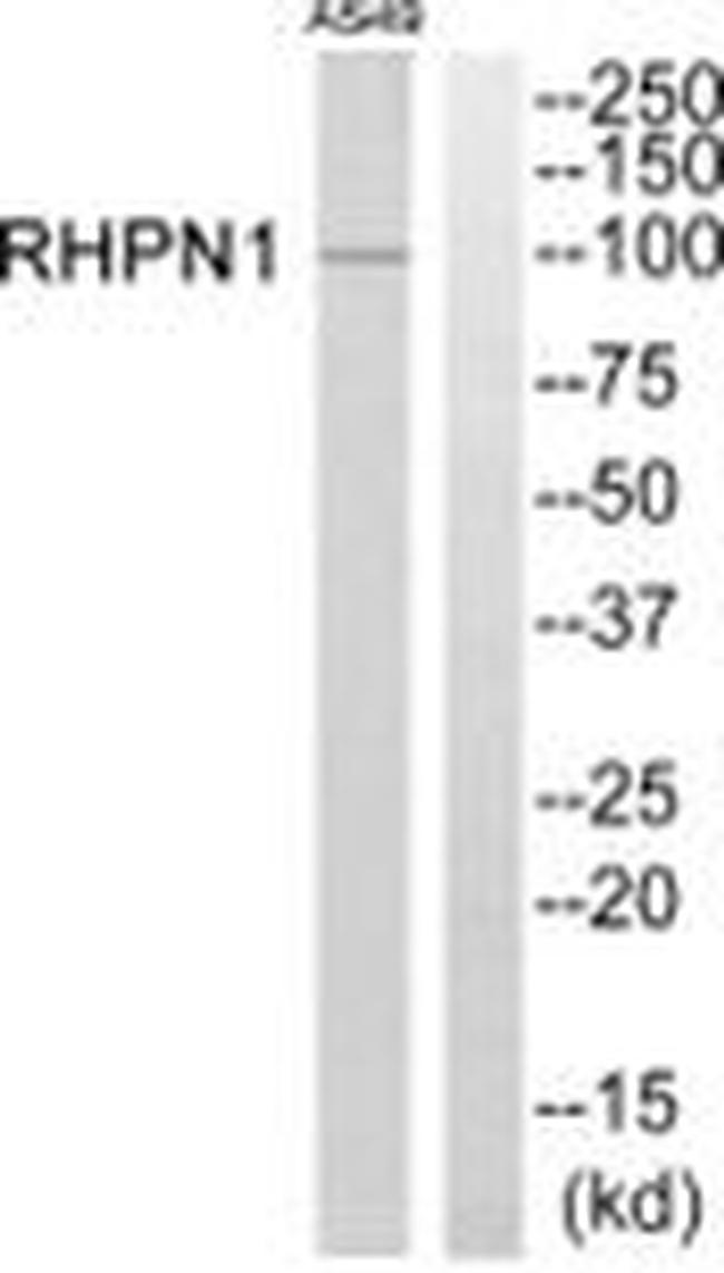 RHPN1 Antibody in Western Blot (WB)