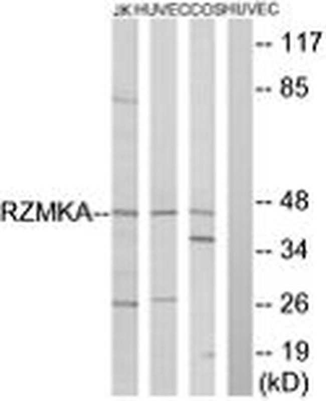 RIMKLA Antibody in Western Blot (WB)
