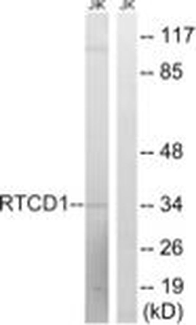 RTCA Antibody in Western Blot (WB)