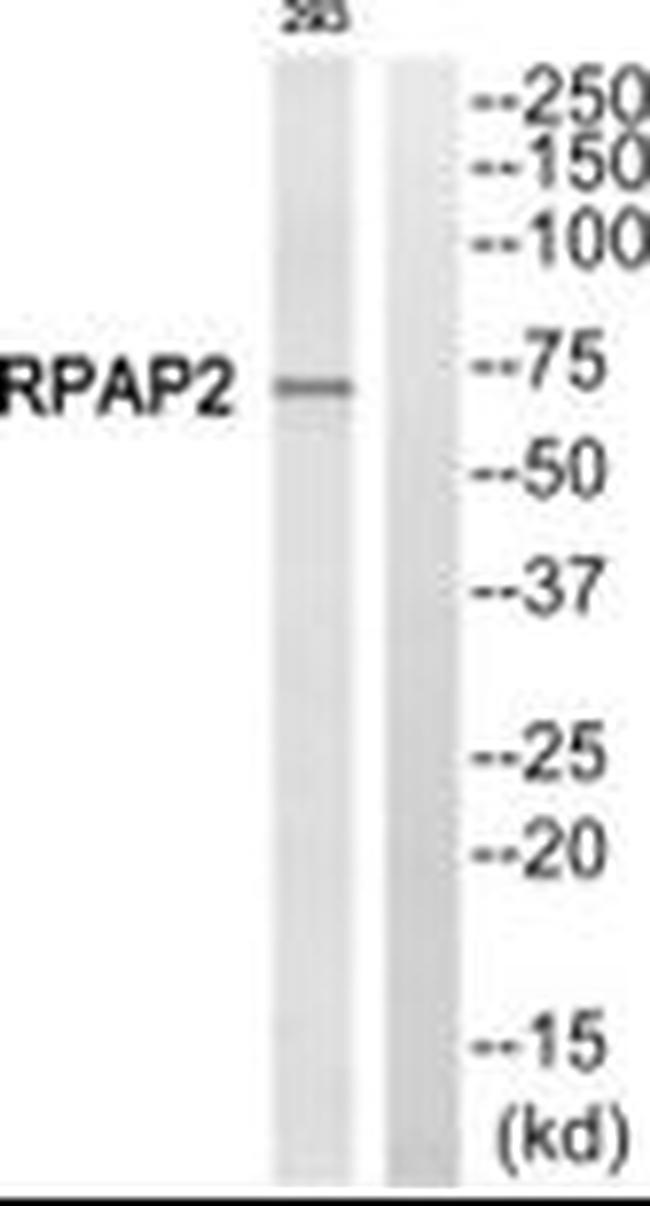 RPAP2 Antibody in Western Blot (WB)