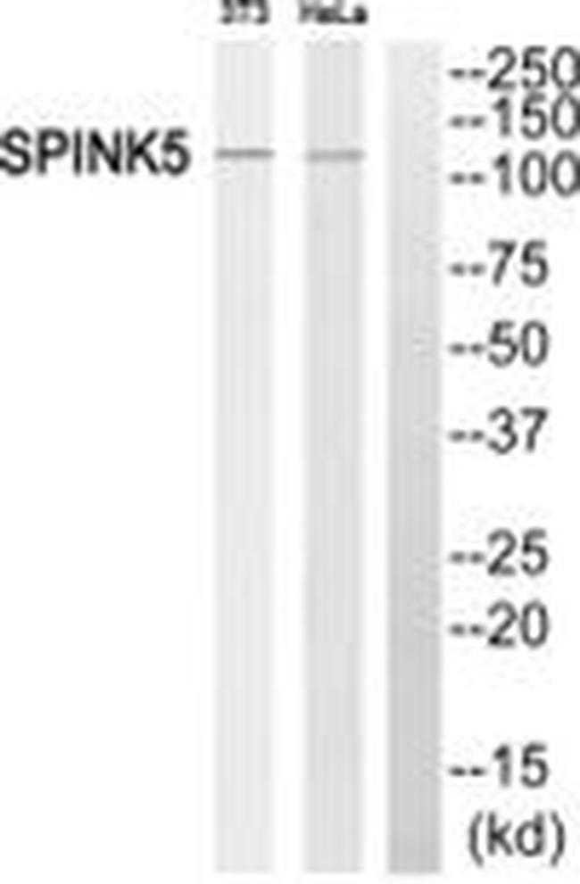 SPINK5 Antibody in Western Blot (WB)