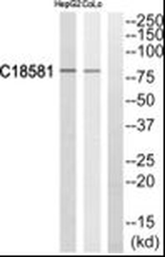 NEK5 Antibody in Western Blot (WB)