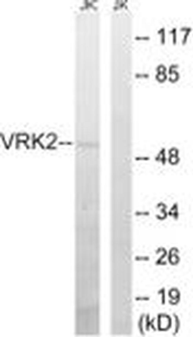 VRK2 Antibody in Western Blot (WB)