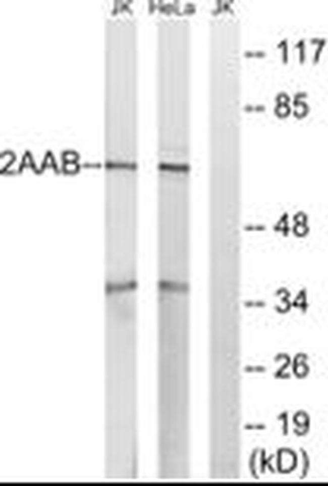 PPP2R1B Antibody in Western Blot (WB)