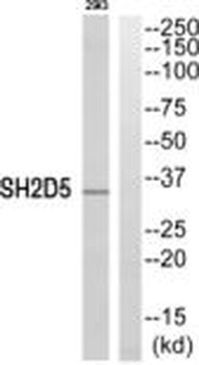 SH2D5 Antibody in Western Blot (WB)