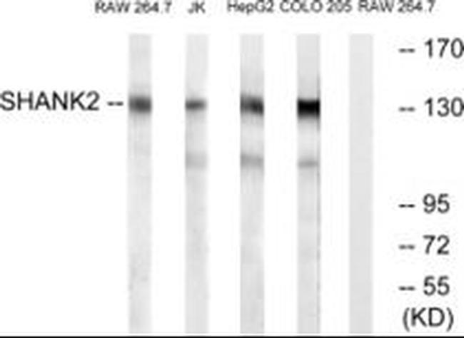 SHANK2 Antibody in Western Blot (WB)