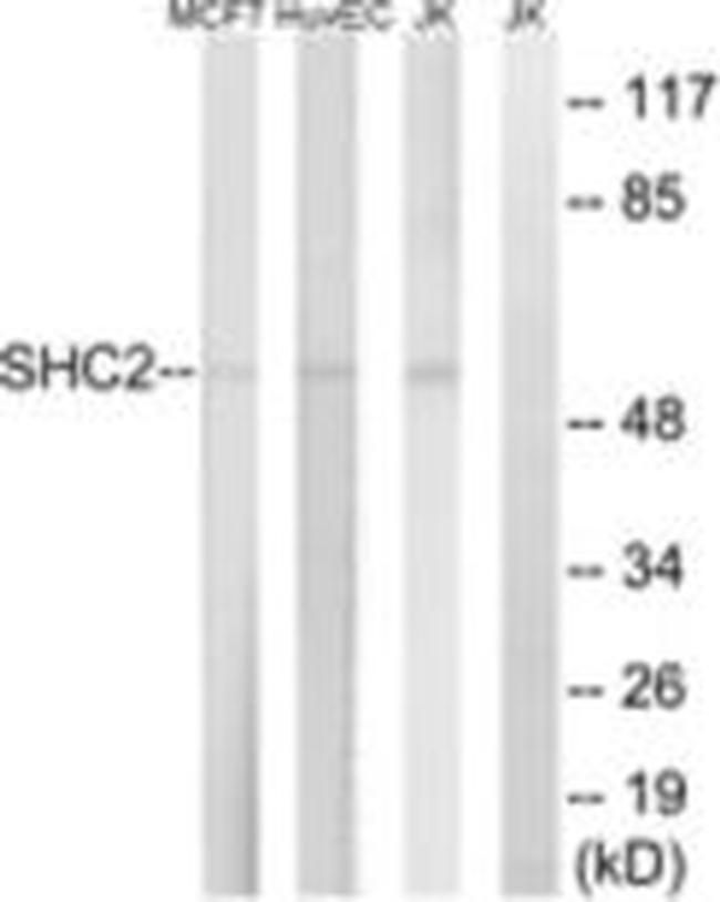 SCK Antibody in Western Blot (WB)