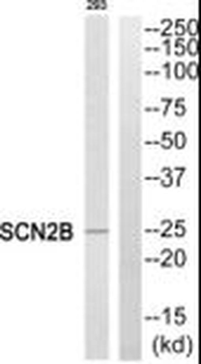 SCN2B Antibody in Western Blot (WB)