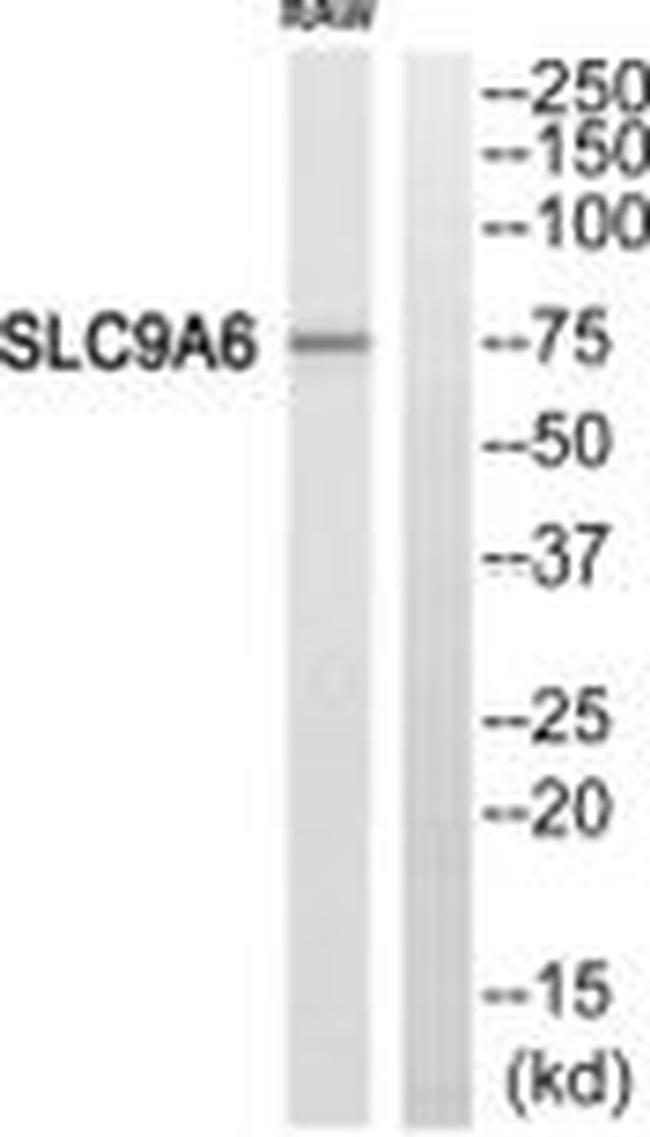 SLC9A6 Antibody in Western Blot (WB)