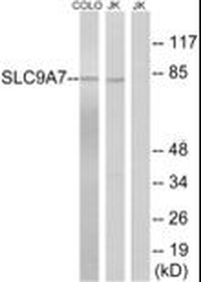 SLC9A7 Antibody in Western Blot (WB)
