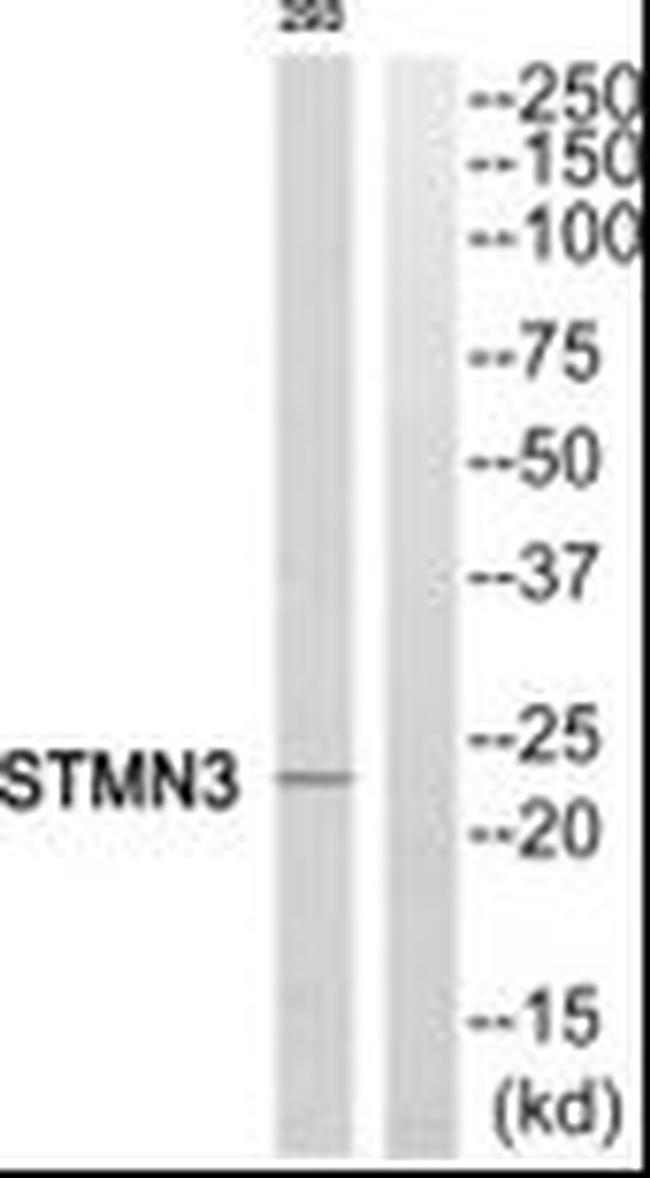 STMN3 Antibody in Western Blot (WB)