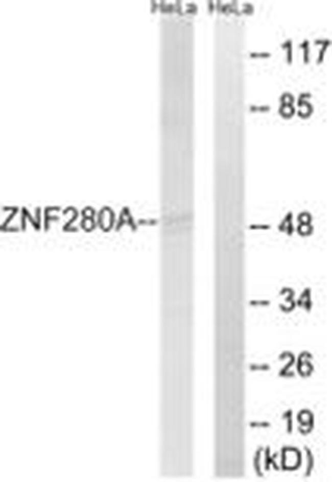 ZNF280A Antibody in Western Blot (WB)
