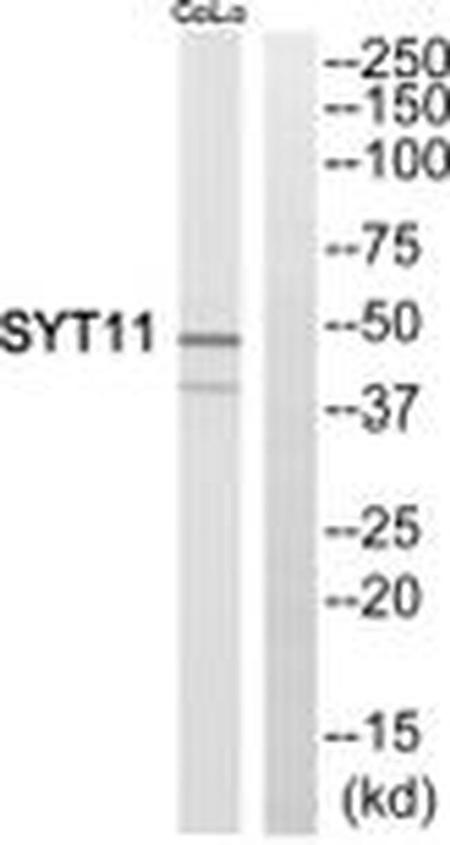 SYT11 Antibody in Western Blot (WB)