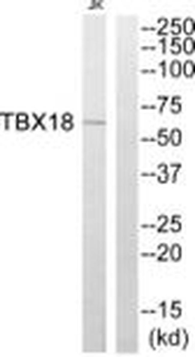TBX18 Antibody in Western Blot (WB)