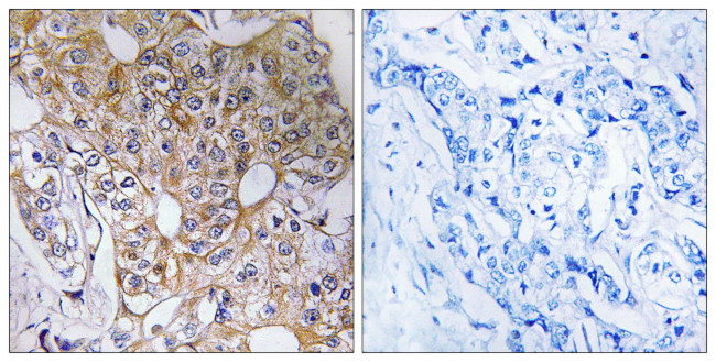 TCP-1 zeta Antibody in Immunohistochemistry (Paraffin) (IHC (P))