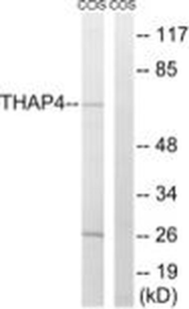 THAP4 Antibody in Western Blot (WB)