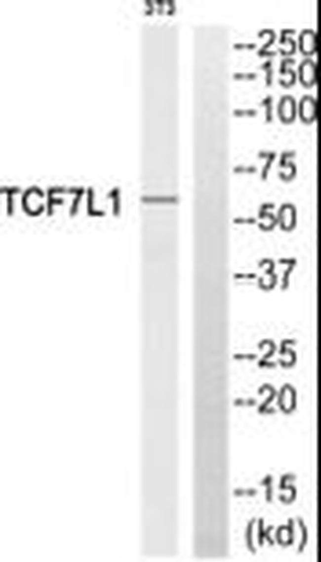 TCF7L1 Antibody in Western Blot (WB)