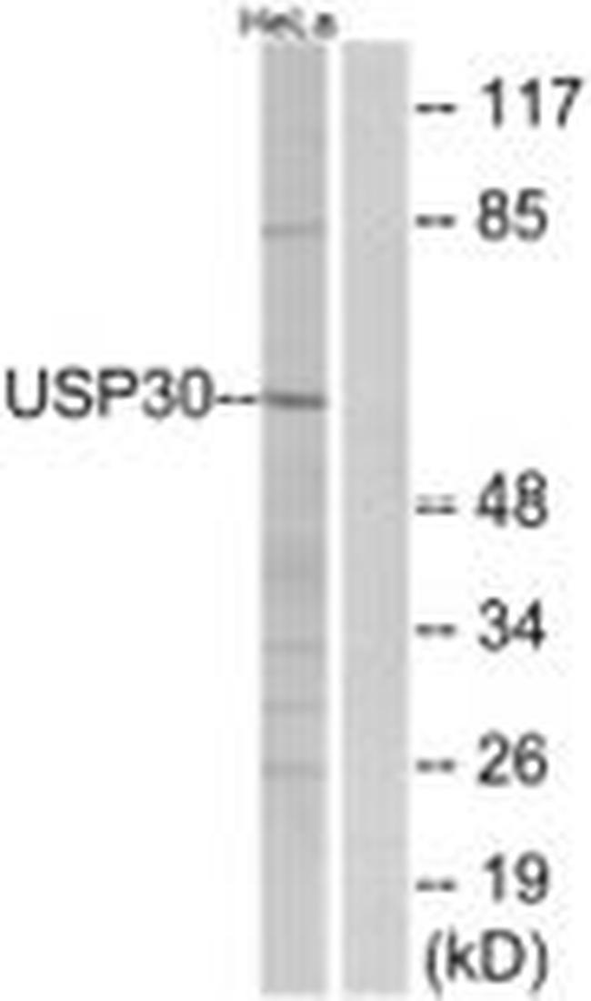 USP30 Antibody in Western Blot (WB)
