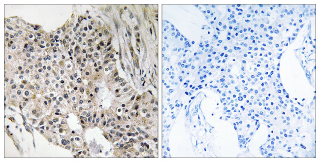 UEVLD Antibody in Immunohistochemistry (Paraffin) (IHC (P))
