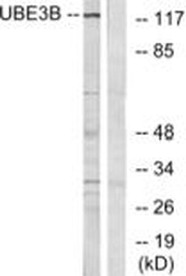 UBE3B Antibody in Western Blot (WB)