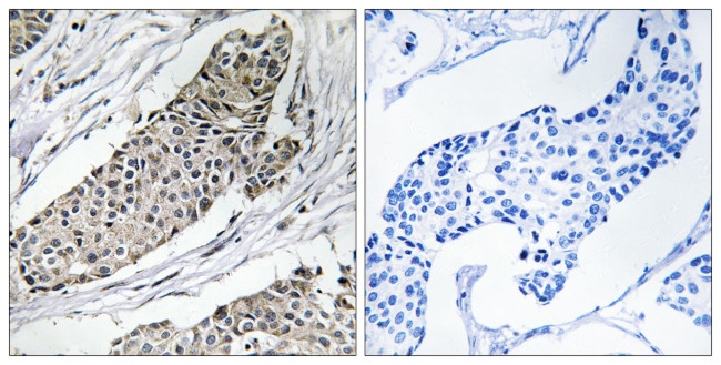KCNAB3 Antibody in Immunohistochemistry (Paraffin) (IHC (P))