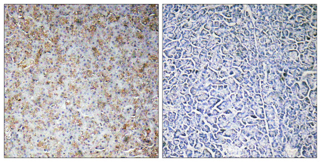 WAVE2 Antibody in Immunohistochemistry (Paraffin) (IHC (P))