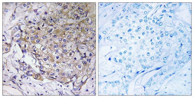 WASF3 Antibody in Immunohistochemistry (Paraffin) (IHC (P))