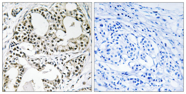 YEATS2 Antibody in Immunohistochemistry (Paraffin) (IHC (P))